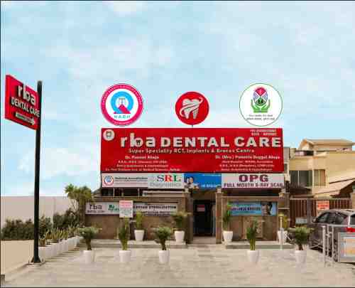 Root Canal Treatment Faridabad